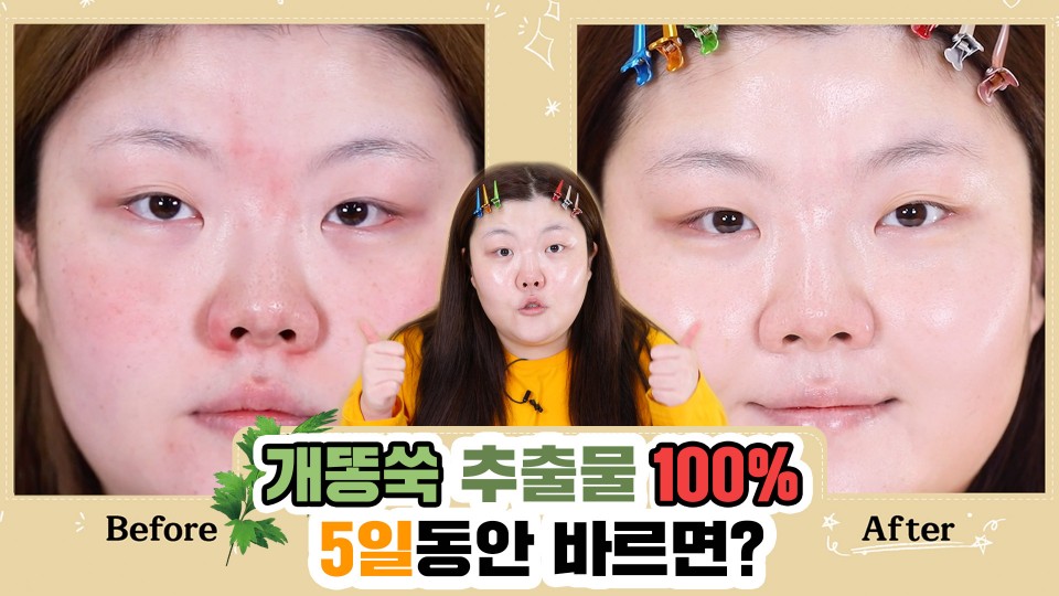 뷰티 크리에이트 홀리가 인스타그램에 올린 미샤 아르테미시아 에센스 사용 전후 모습.